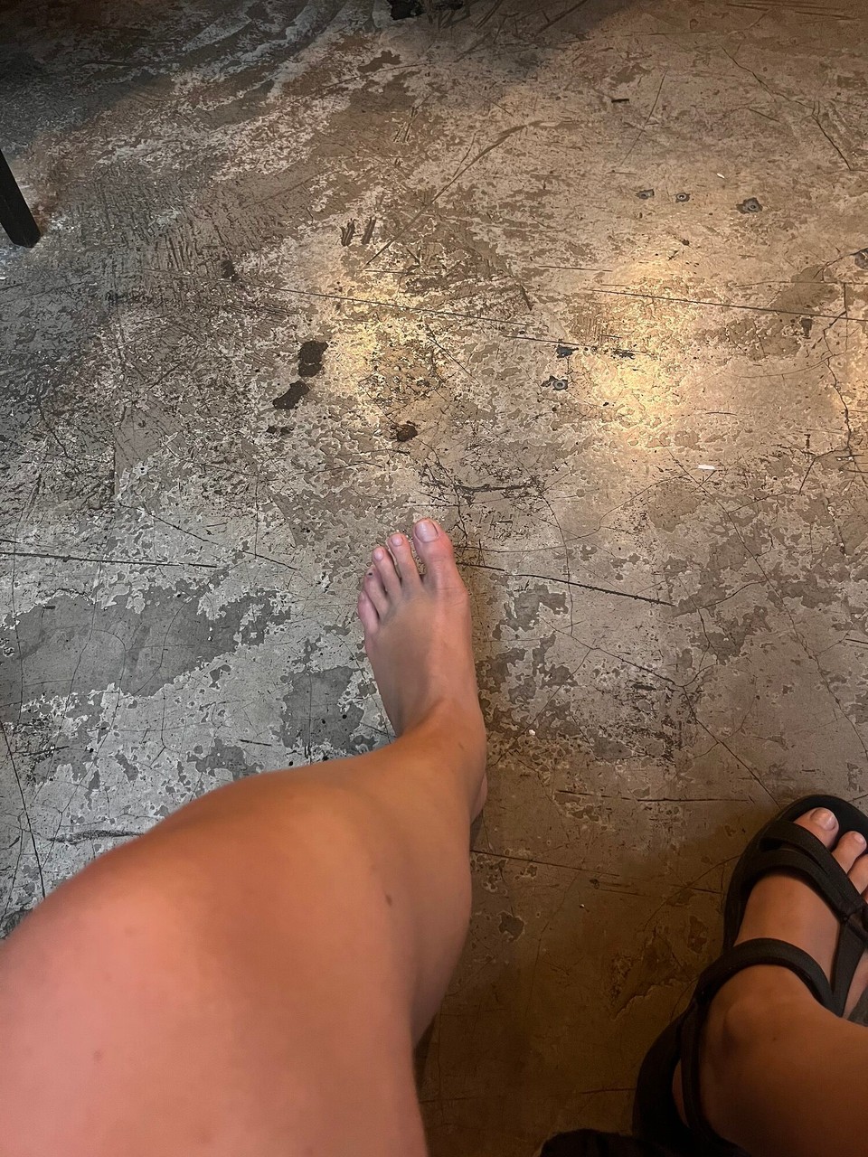 Malaysia - Kuala Lumpur - Foot update! Swelling has gone down massively, the coolness in the highlands may have helped with that. Still have a solid lump on my shin though and it hurts a bit all over, maybe from the swelling 