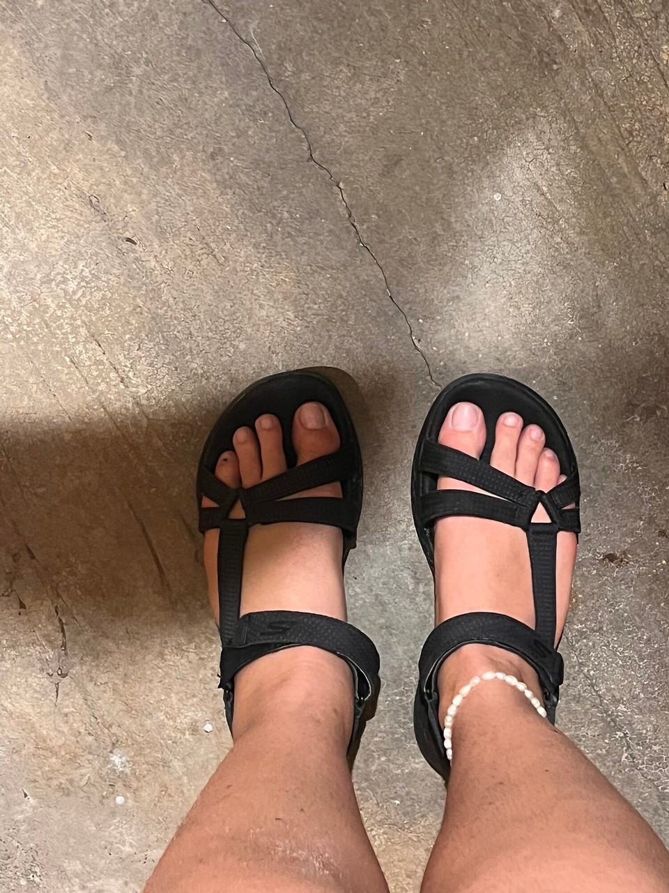 Malaysia - Georgetown - Leg update. Sausage foot