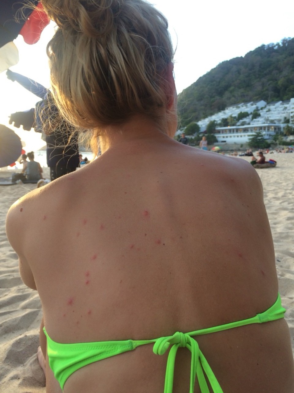 Thailand - Rawai - Fenistil mein bester Freund :(