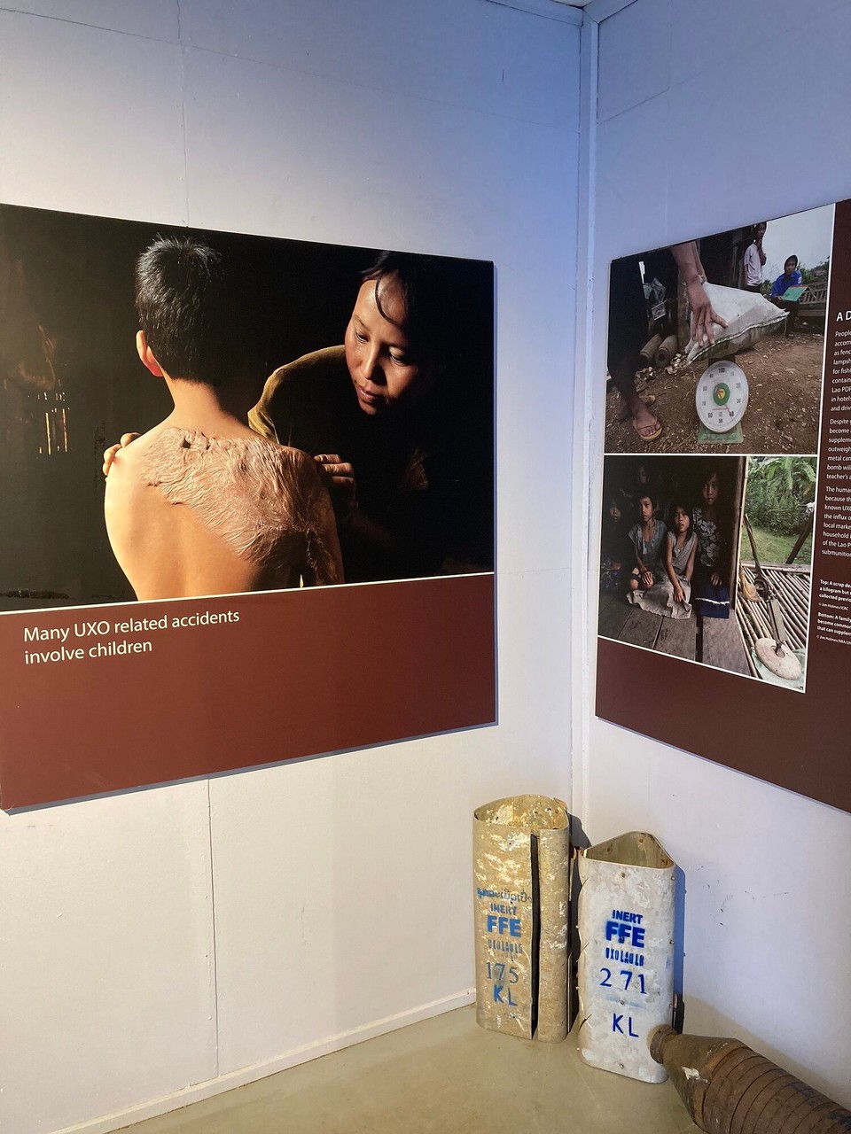 Laos - Luang Prabang - Die Kinder leiden besonders häufig, weil sie entweder nach Metall suchen um es zu verkaufen um so die Familie zu unterstützen oder auch weil sie damit spielen und sie dann explodieren oder weil sie durch die Feldarbeit darauf stoßen