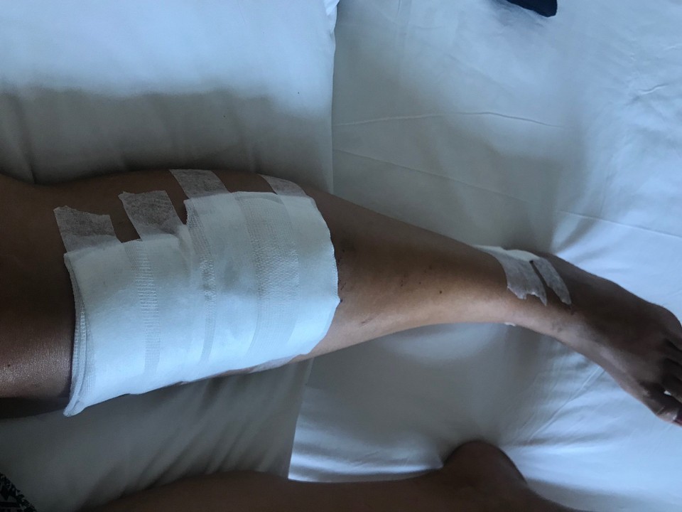 Philippines - El Nido - Har i det minste klart å sentrere alt på samme bein. 