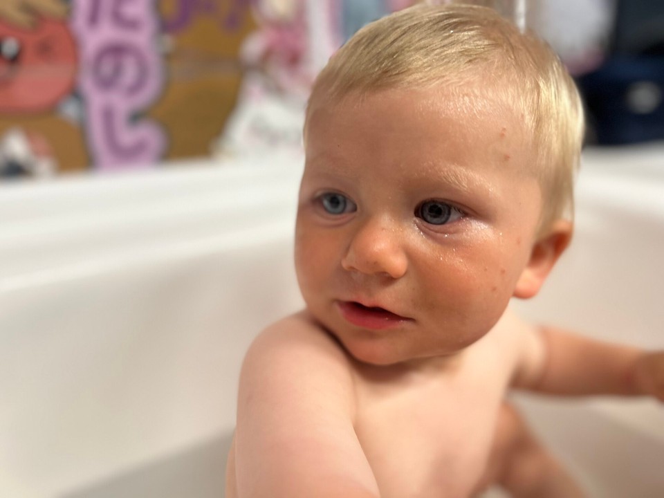 Frankreich - Biguglia - 