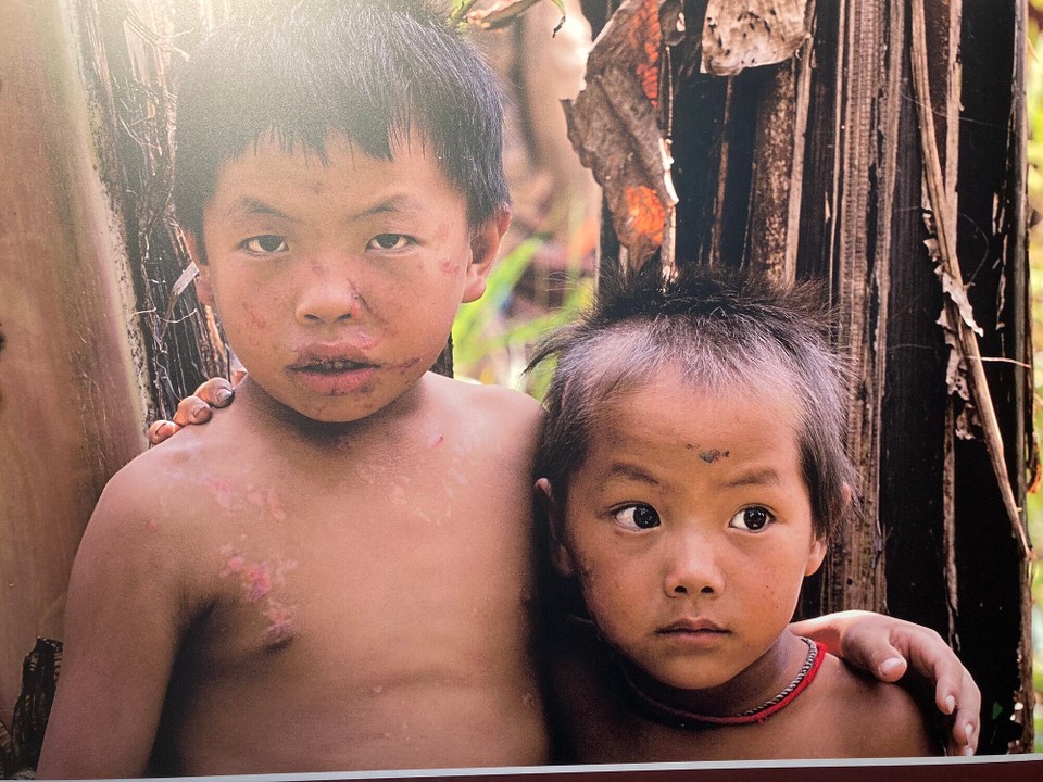 Laos - Luang Prabang - Trotz Suchaktionen und Aufklärungsarbeit sterben jährlich noch bis zu 300 Menschen