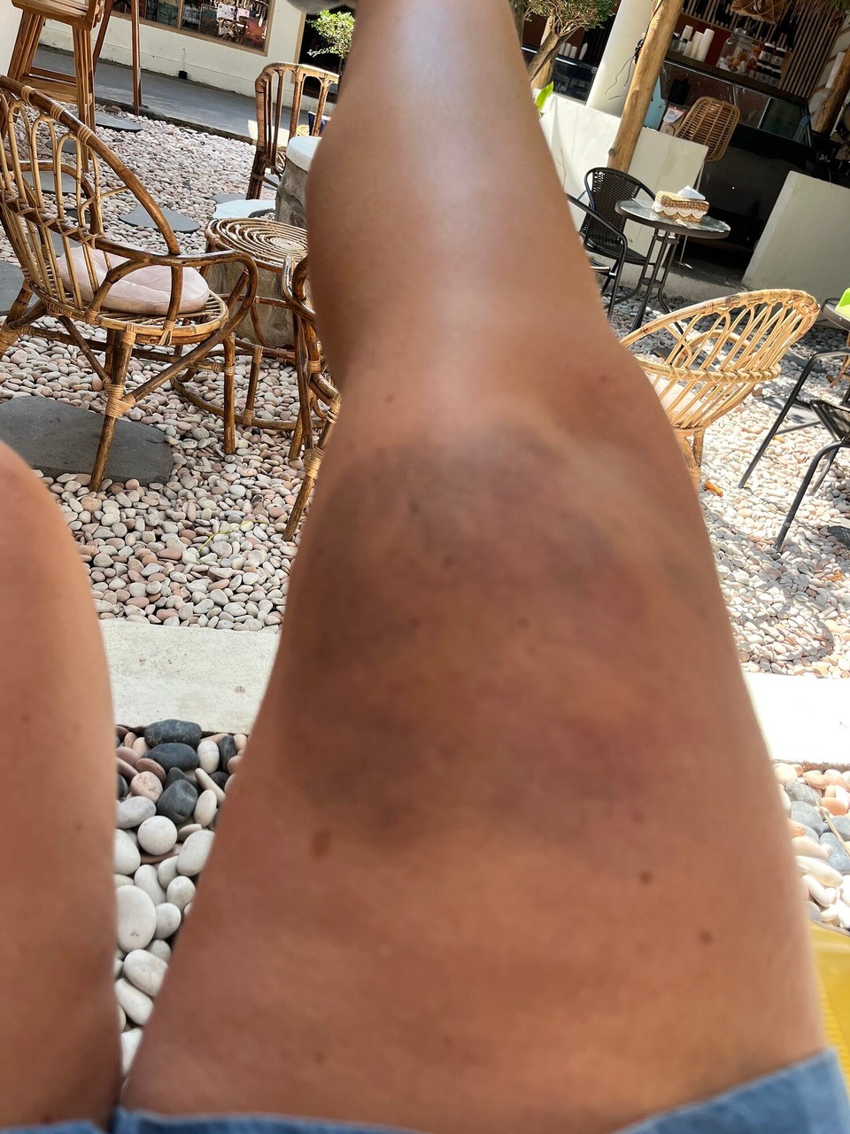 Indonesia - Kabupaten Lombok Utara - 