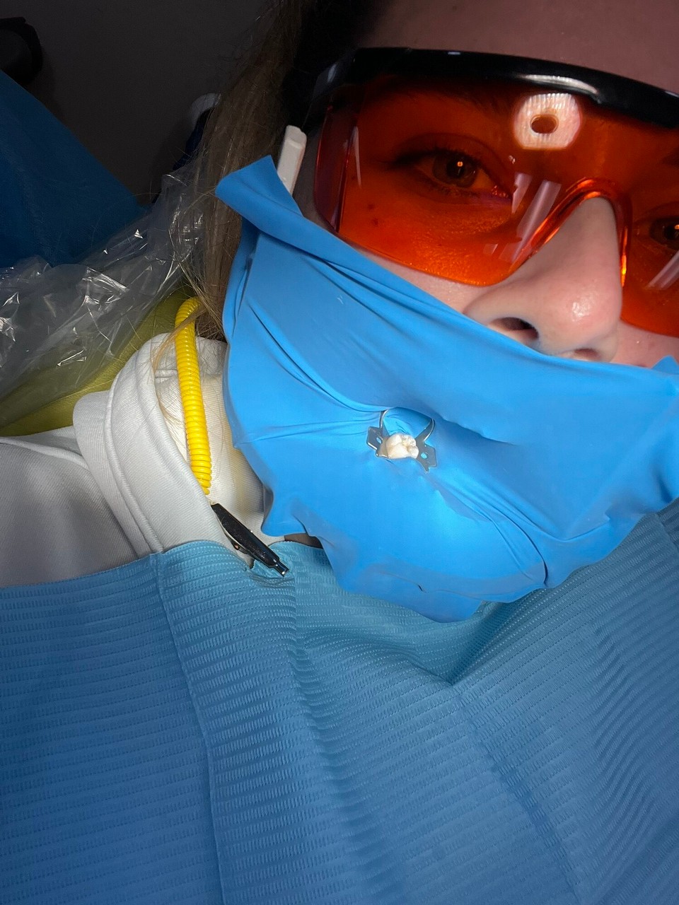 Costa Rica - San José - Am Mäntig het sie mir denn es Löchli gflickt. Gseht hübsch us oder? 