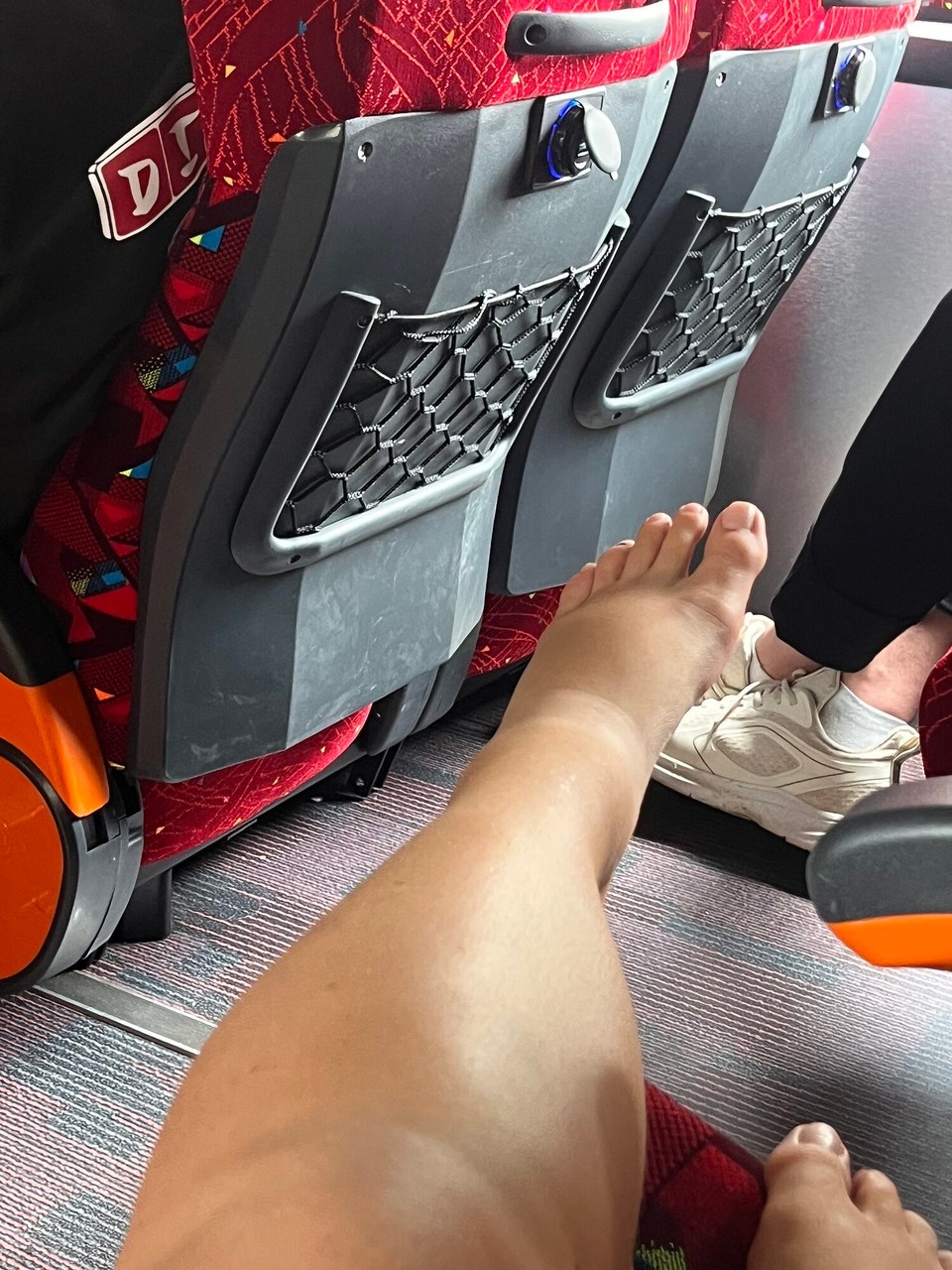 Malaysia - Georgetown - Fooot update. So so swollen and starting to bruise but least the bruise and lump is draining. But now it’s on my foot and drained from my shin, it has nowhere to go? So what happens to my foot? Stay tuned 