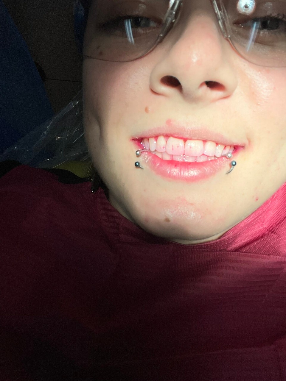 Costa Rica - San José - Am Fritig hani no be de Studentin wo da wohnt en Zahreinigung gmacht. Sie het sogar mini Lippe und alles untersuecht und Röntgebilder gmacht. So gnau bin i glaub no nie abcheckt worde. De Zahnarzt wo ihri Arbet kontrolliert het sogar echli dütsch chönne & kennt Aarau.ps: ish e paste, kei Bluet