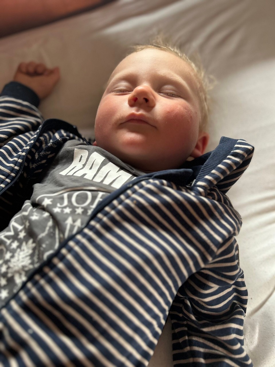 Frankreich - Biguglia - 