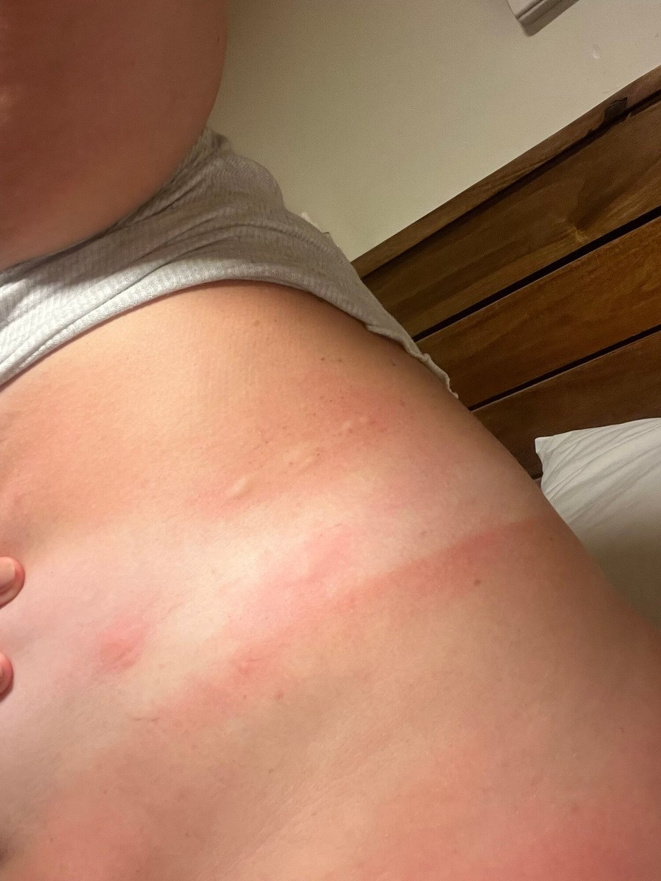 Philippines - General Luna - Was getting eaten so if e in my bed? No bedbugs though. Couldn’t fin the culprit. 