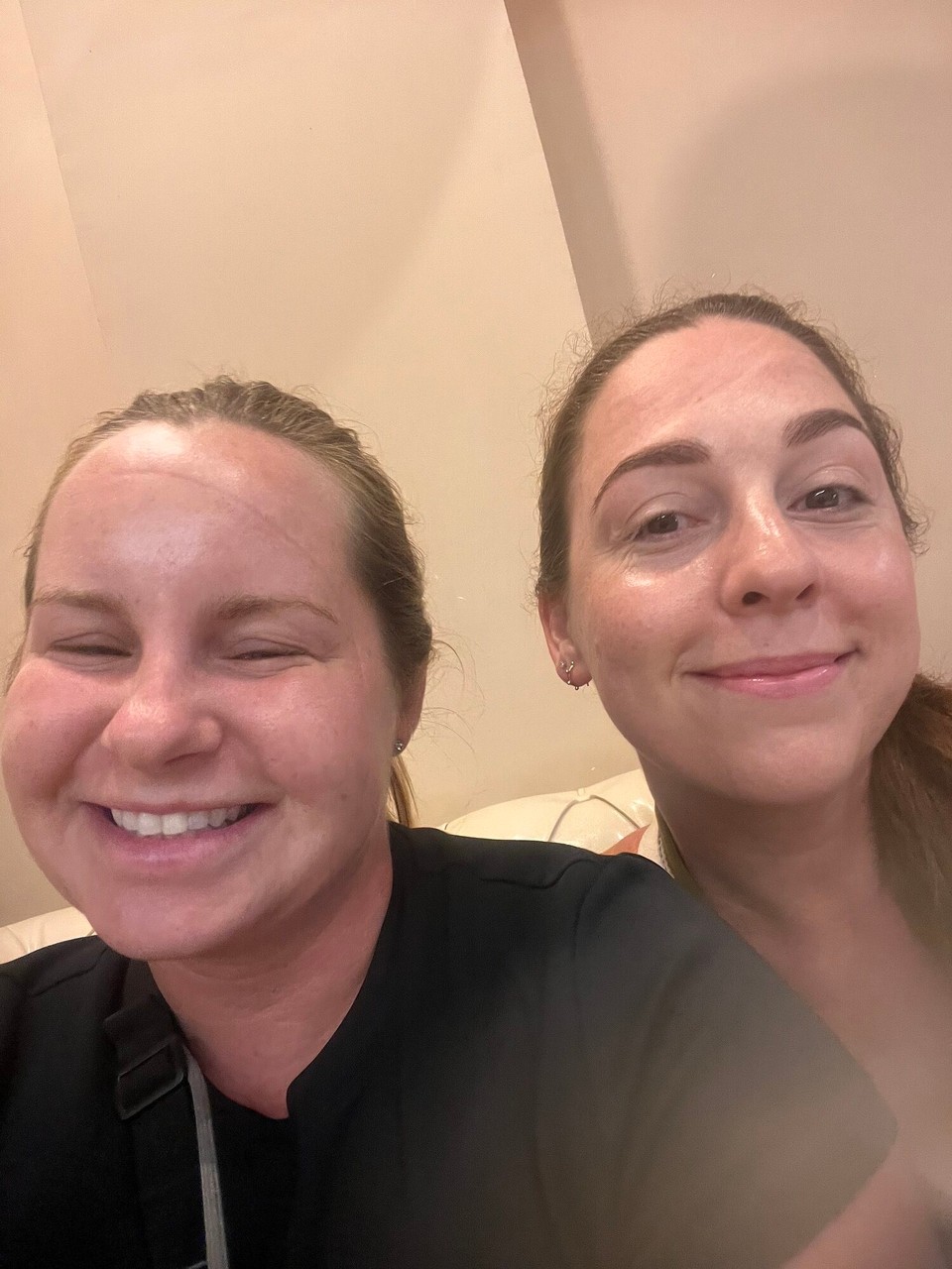 Vietnam - Hanoi - Puffiest eyes and dents after a massage 