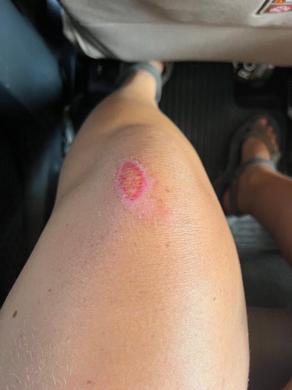 Indonesia - Kabupaten Lombok Barat - 