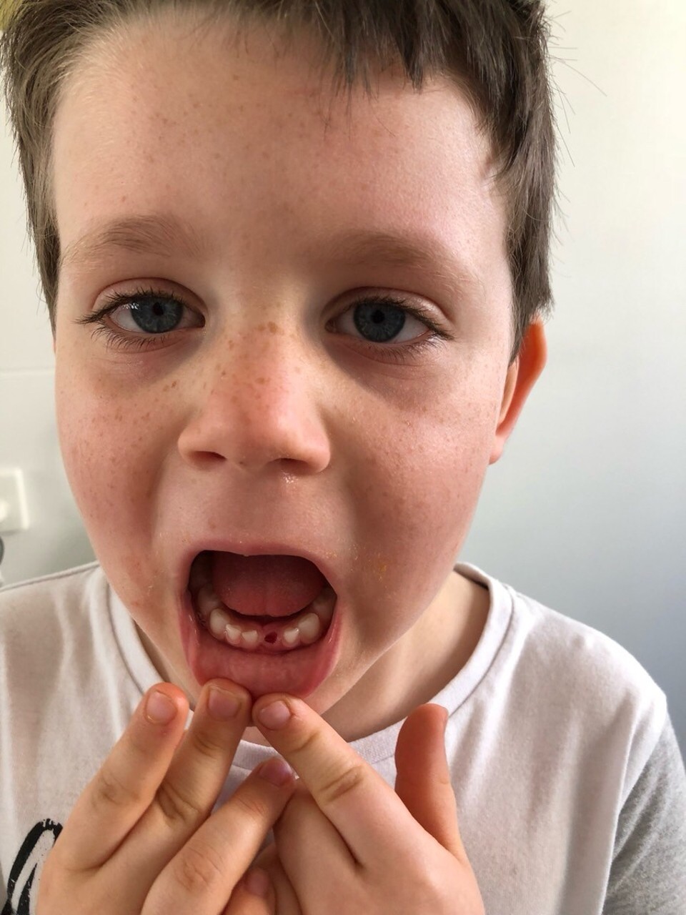  - Australia, Adelaide - Joshua lost his first tooth