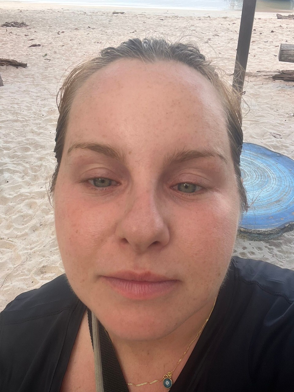 Malaysia - Georgetown - I forgot I was allergic to cats. Not fun