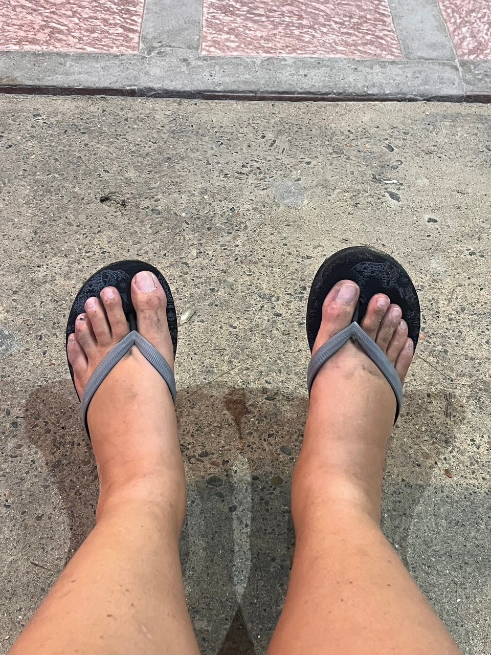 Philippines - El Nido (Bacuit) - lol maybe being on all these drugs and two swollen ankles from injuring myself anyways and on the heat and standing all day fucked turn up a bit but they’ll go down ahah 