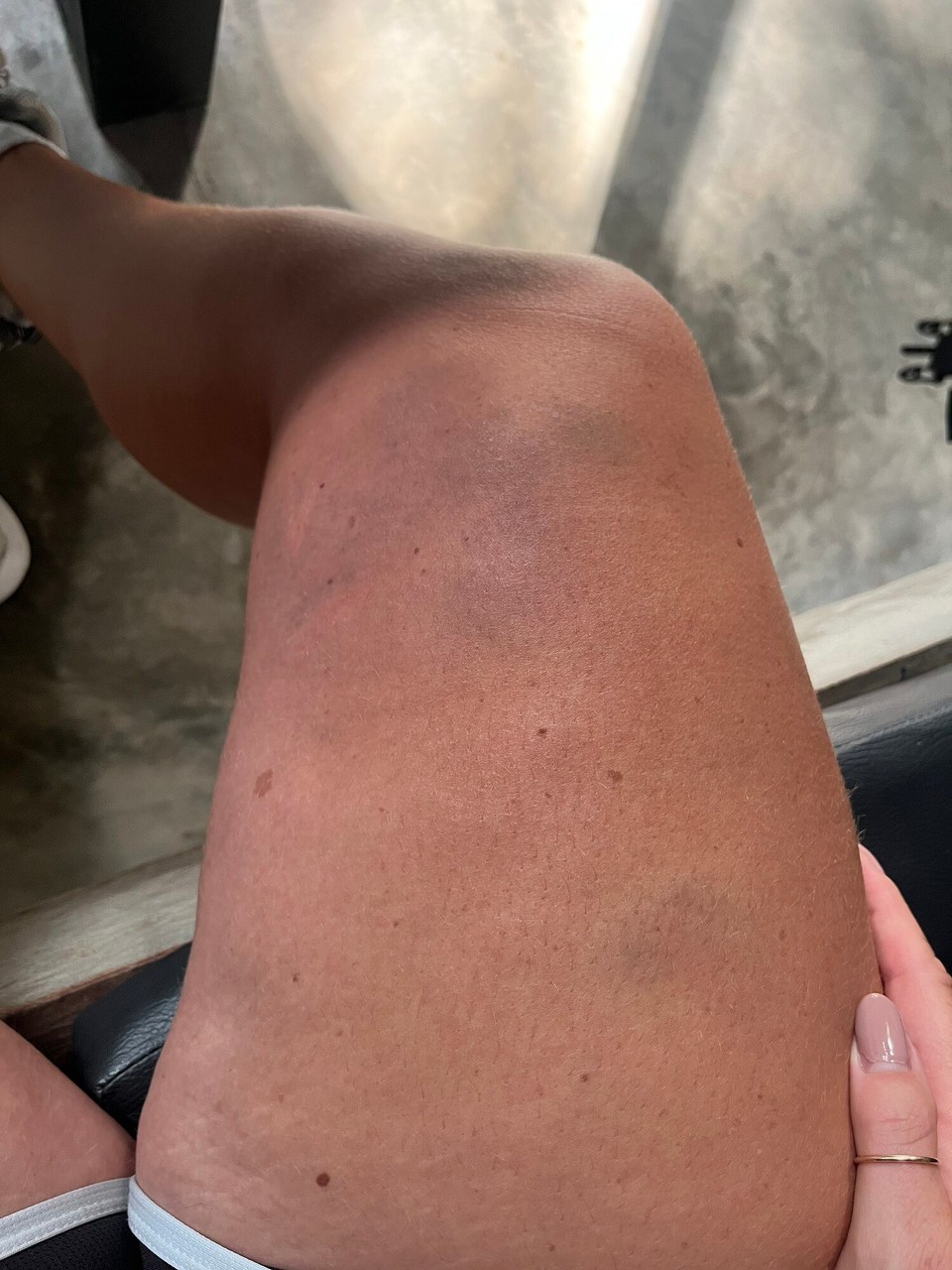 Indonesia - Klungkung - 