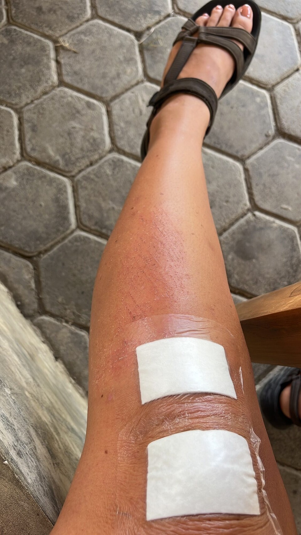 Indonesia - Kabupaten Lombok Tengah - 