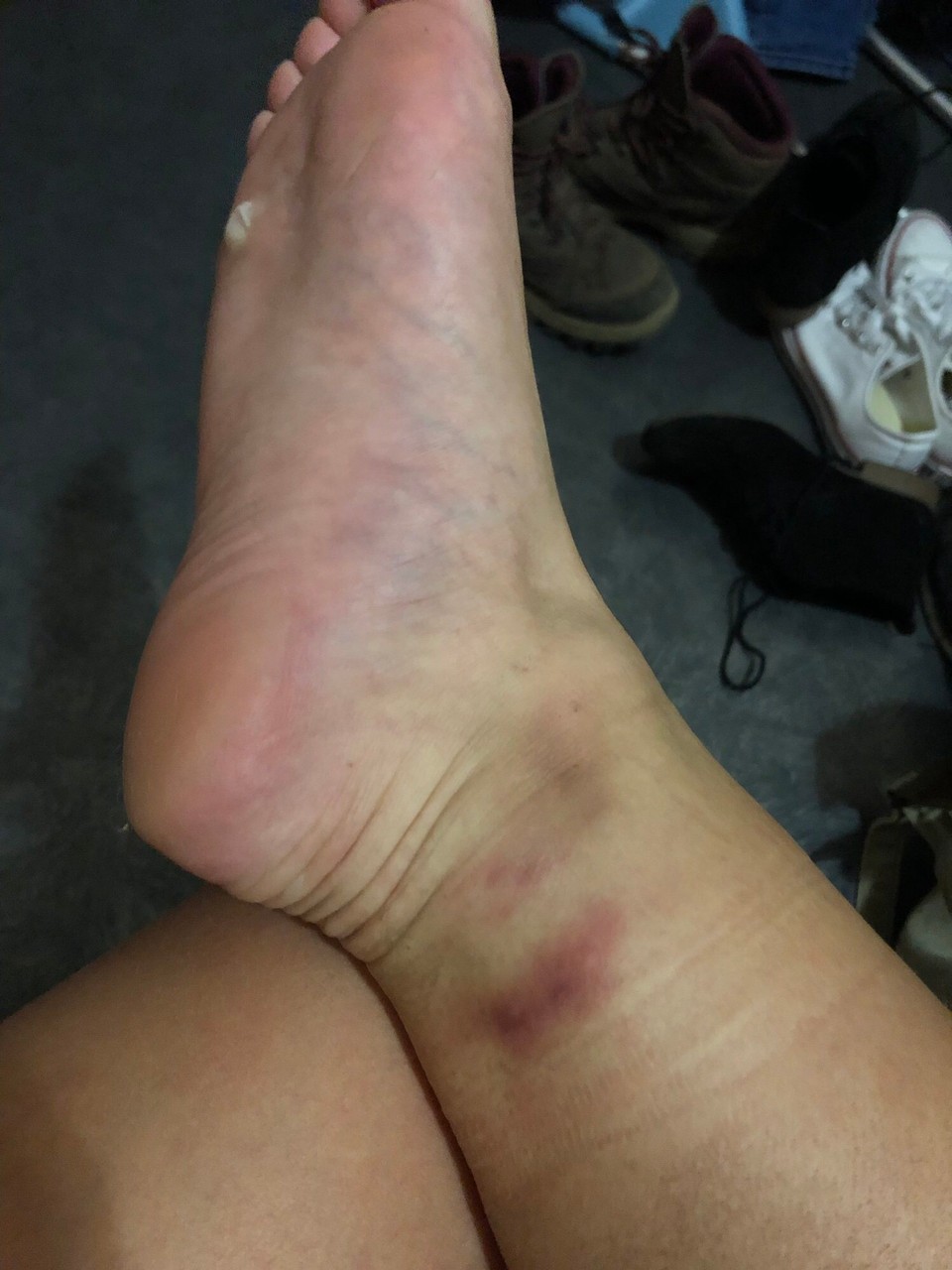 Frankreich - Allemond - Meine Füße müssen sich noch etwas an riesige Wanderungen gewöhnen