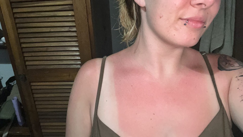 Costa Rica - Puntarenas - Am Sunntig simmer denn an Strand und natürlich gaht da be mir nit ohni Sunnebrand. Aschlüssend simmer mitem Bus zrugg uf San Jose und det startet die neu Wuche